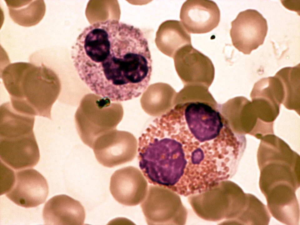 Light microscopy image showing a neutrophil with its characteristic multi-lobed dark nucleus and an eosinophil with a bilobed pink nucleus, surrounded by smaller red blood cells