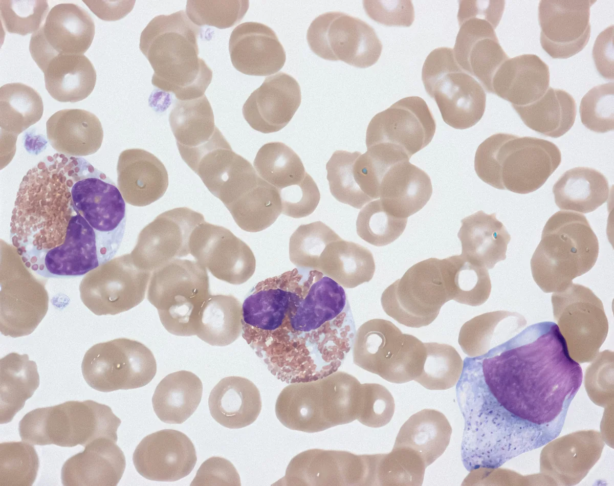 Microscope image of white blood cells including neutrophils and lymphocytes in blood