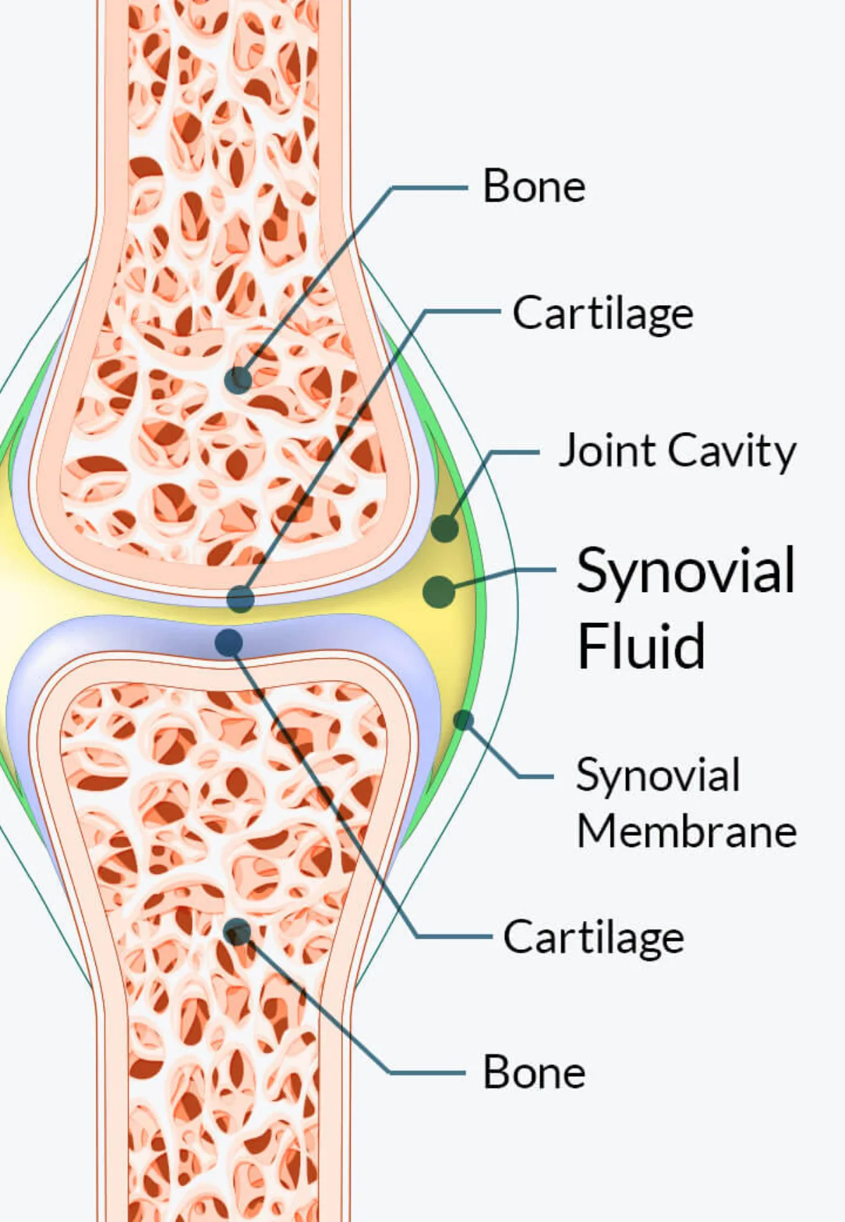 Anatomical diagram showing synovial joint structure with bone, cartilage, joint cavity and synovial fluid labeled