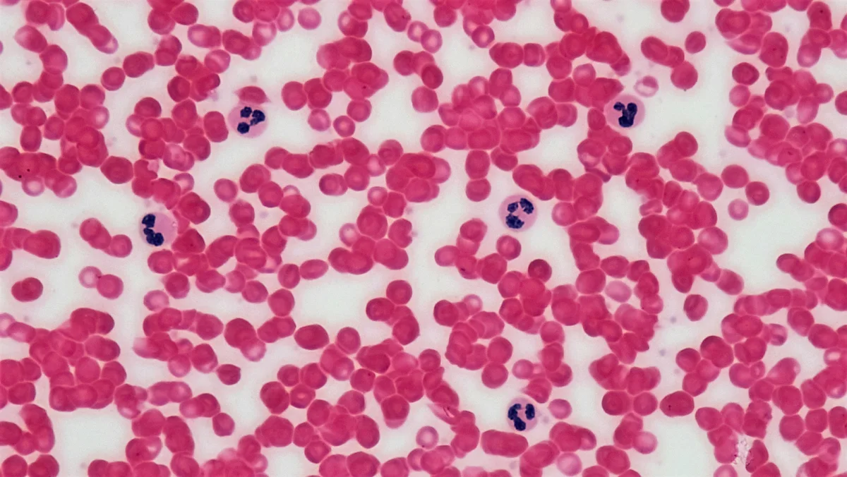 Microscopic view of red blood cells and white blood cells in a blood smear