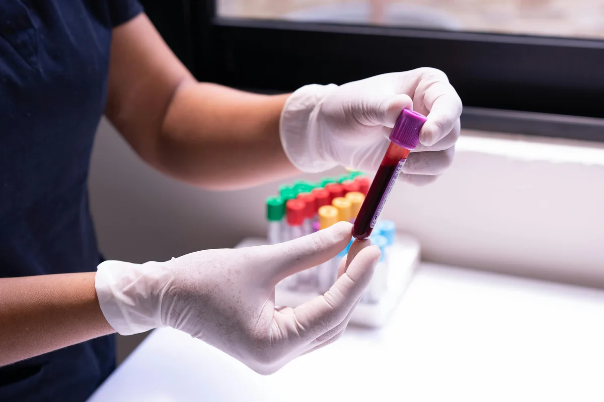 Healthcare professional handling a blood sample tube in a laboratory