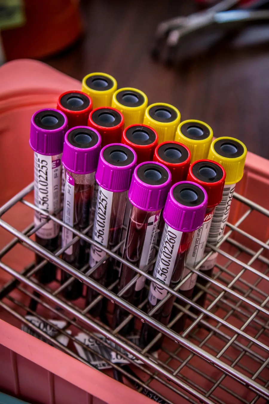 Multiple blood collection tubes with different colored caps in a laboratory rack